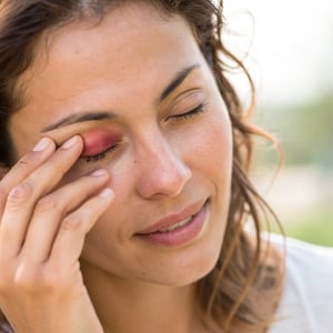 What Causes Eyelid Dermatitis and How to Spot It Early